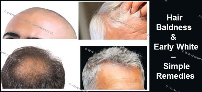 Hair Baldness white hair Hair Baldness white hair