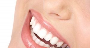 teeth diseases smile