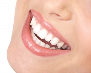 teeth smile teeth diseases smile